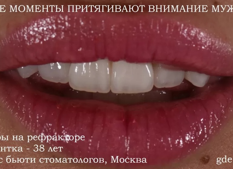 Нашла прекрасную идею, как познакомить малыша с геометрическими фигурами, которые он должен различать к школе